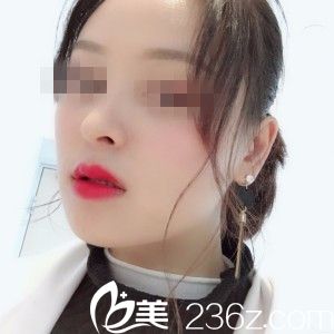 术后20天 术后20天