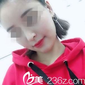 术后一个月 术后一个月