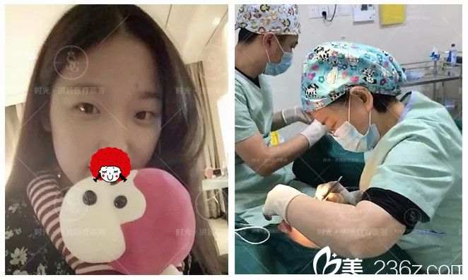 眼综合激光美肤整形手术过程中