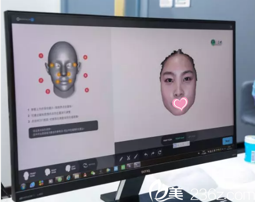 北京上上相整形美容医院郑楚蓉面部脂肪修复案例脸部分析照 北京上上相整形美容医院郑楚蓉面部脂肪修复案例脸部分析照