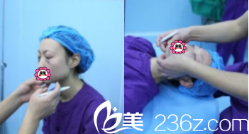 北京解放军309医院整形美容烧伤修复中心祛眼袋设计照