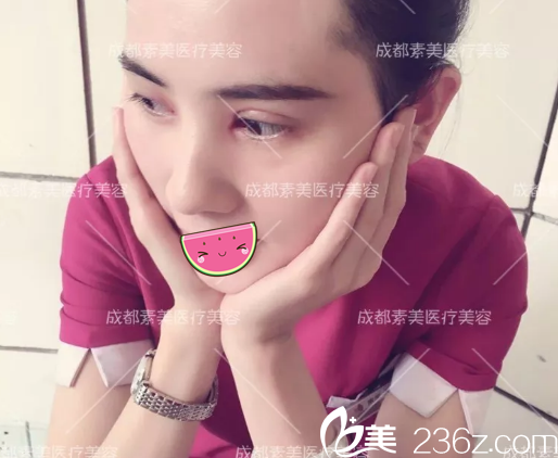 <!--<i data=20240703-sp></i>-->双眼皮拆线后效果 <!--<i data=20240703-sp></i>-->双眼皮拆线后效果