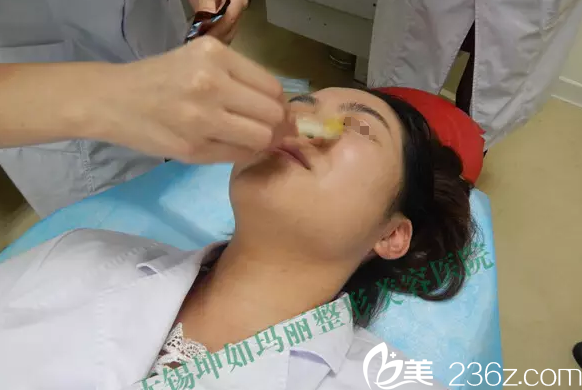 注射隆鼻术前的清洁和消毒