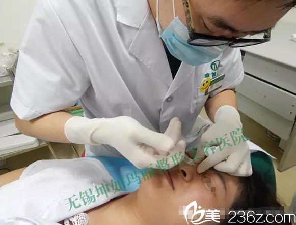 鼻背部注射玻尿酸