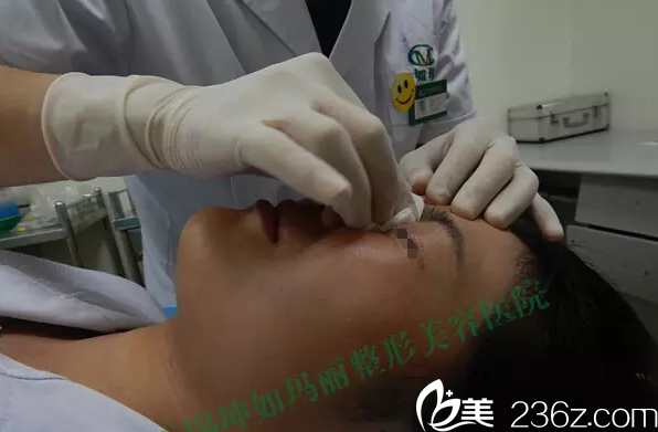 玻尿酸的塑形过程