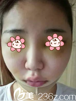 朴正日院长刚给我手术完 朴正日院长刚给我手术完