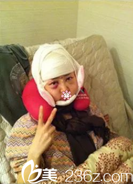 姬广翰医生给我做完术后3天 姬广翰医生给我做完术后3天