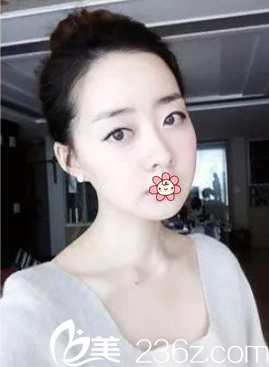 术后两个月 术后两个月