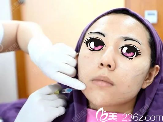 连天美注射玻尿酸填充过程 连天美注射玻尿酸填充过程