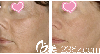 韩国Stanley皮肤科皮肤美容效果展示