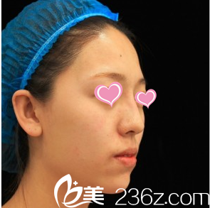 韩国Stanley皮肤科李恩硕案例 韩国Stanley皮肤科李恩硕案例