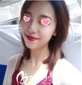 韩国Stanley皮肤科治疗后17天样子 韩国Stanley皮肤科治疗后17天样子