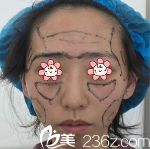 朱红振医生给我面诊