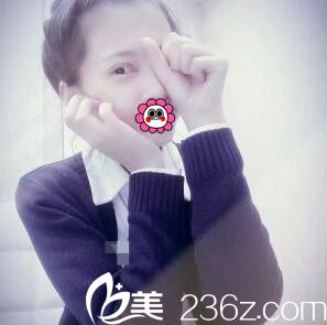 术后一周拆线 术后一周拆线