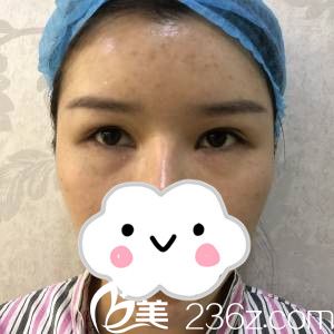 手术前的我 手术前的我