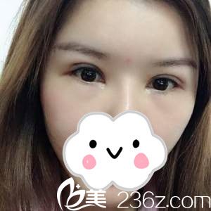 术后一周 术后一周