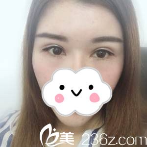 手术第18天 手术第18天