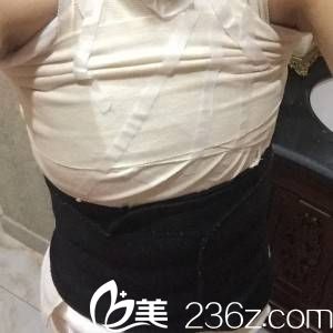 手术当天 手术当天