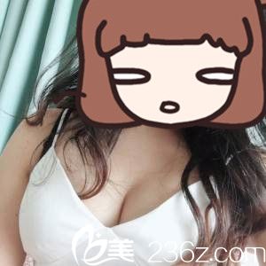 手术后第20天 手术后第20天