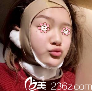 才俊明医生给我术后第三天 才俊明医生给我术后第三天