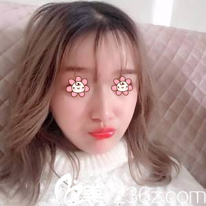 一周拆线 一周拆线