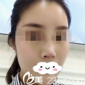 术后一周 术后一周