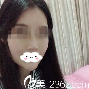 手术后第十天 手术后第十天