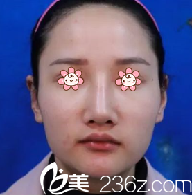 我去新疆黎美整形医院面诊 我去新疆黎美整形医院面诊