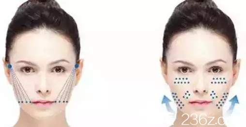 大同美神面部线雕提升图