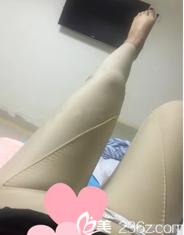 大腿吸脂术后穿着塑身衣 大腿吸脂术后穿着塑身衣