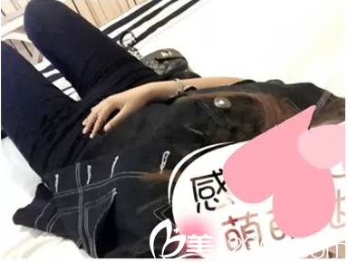大腿粗没有吸脂效果好 不信来看苏州华美孙培灵医生分享的吸脂一个月术后案例