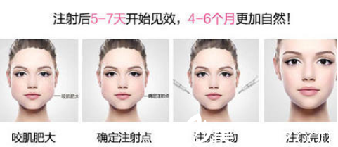 桂林打瘦脸贵不贵？桂林熊名田3980元起就可以注射瘦脸