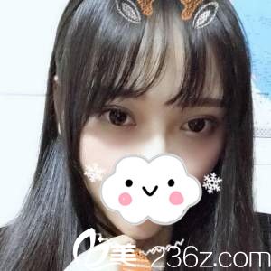 手术后第十八天