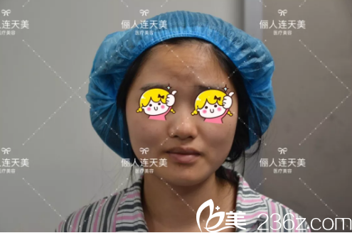 术前鼻子塌问题较多 术前鼻子塌问题较多