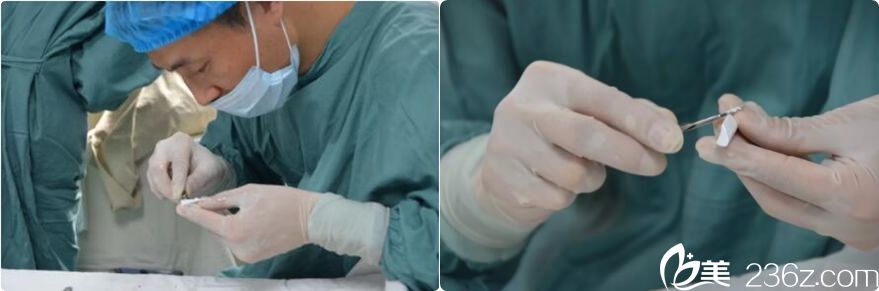 朱如岗院长正在雕刻膨体 朱如岗院长正在雕刻膨体