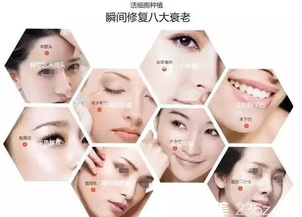 南宁梦想做自体脂肪活细胞移植优势