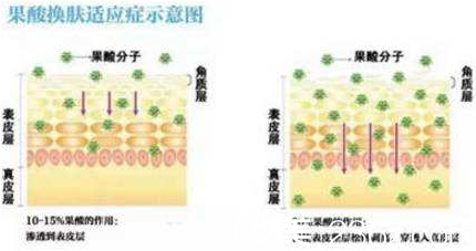 果酸嫩肤的方法