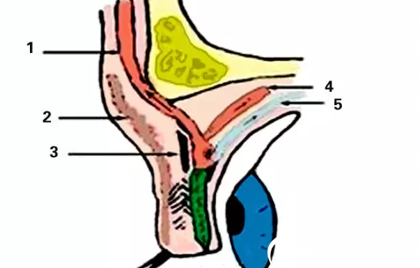 上睑下垂矫正CFS手术 上睑下垂矫正CFS手术