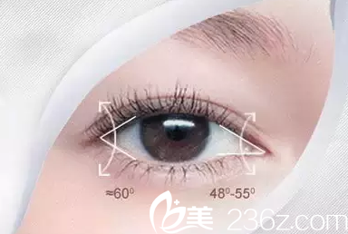 长春开眼角手术价格是多少？长春秀尔开眼角手术7800元起助你拥有美眼