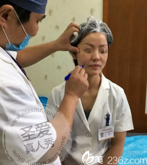 埋线提升术前面诊设计 埋线提升术前面诊设计