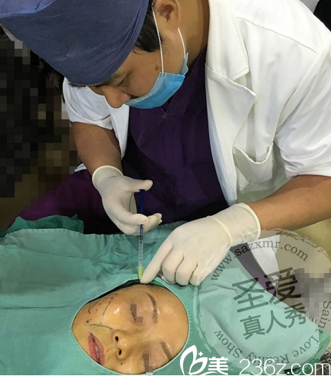 4D精雕塑形面部提升术前麻醉 4D精雕塑形面部提升术前麻醉