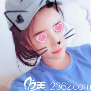 生长因子取出术后64天 生长因子取出术后64天