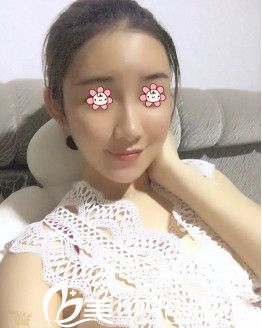 武汉美基元自体脂肪填充怎么样 武汉美基元自体脂肪填充怎么样
