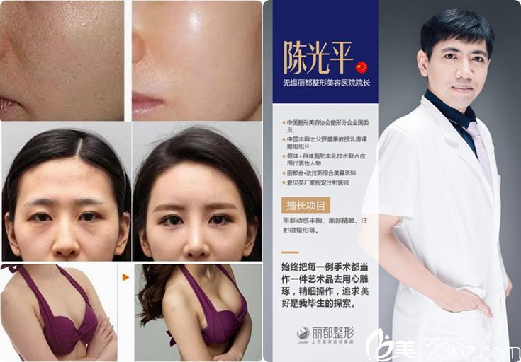 陈光平医生隆胸案例