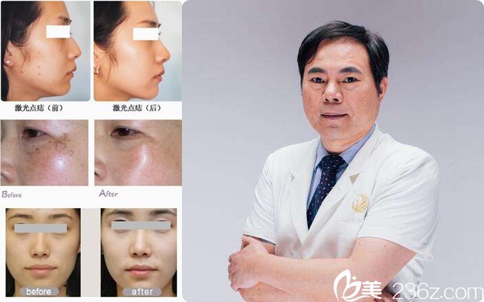 赵坚钢院长整形案例