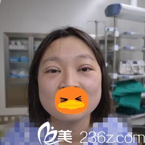 眼综合术后即刻照