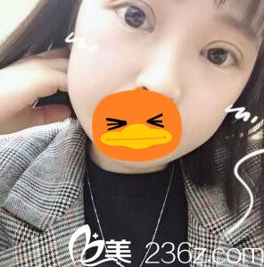 眼综合手术术后10天照