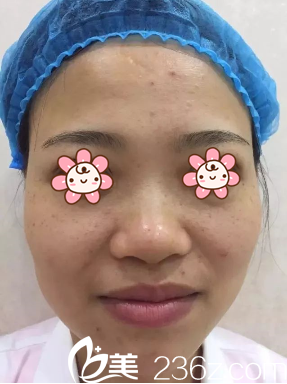 去贵州利美康外科医院治疗的我 去贵州利美康外科医院治疗的我