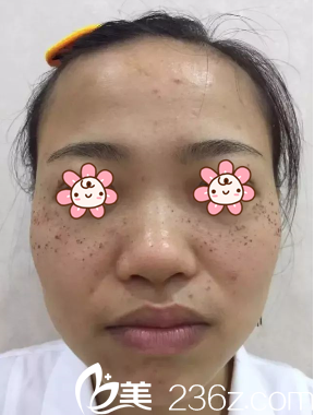 张<!--<i data=20240703-sp></i>-->给我祛斑当天 张<!--<i data=20240703-sp></i>-->给我祛斑当天