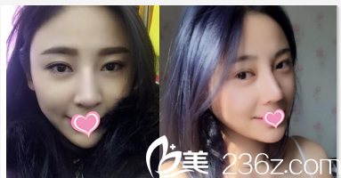 北京圣嘉荣黄大勇隆鼻<span style= 北京圣嘉荣黄大勇隆鼻<span style=